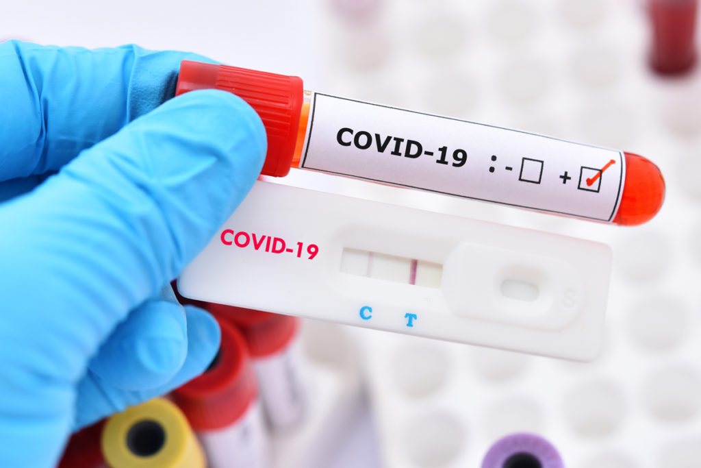 UAE-ites To Pay Fines Up To AED 50,000 If They Fail To Declare Any Covid-19 Positive Tests