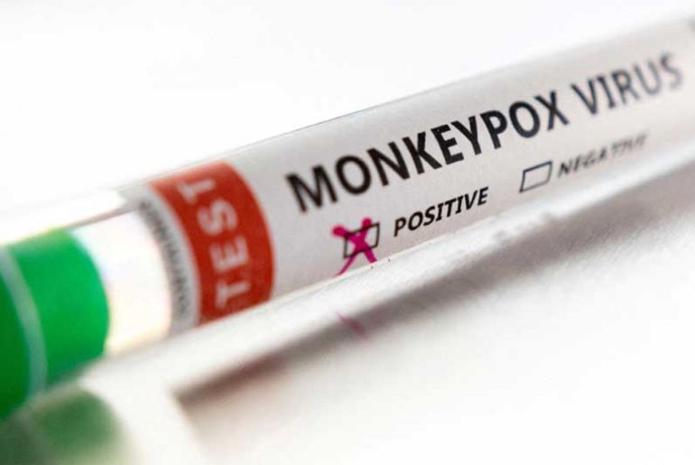 Monkeypox