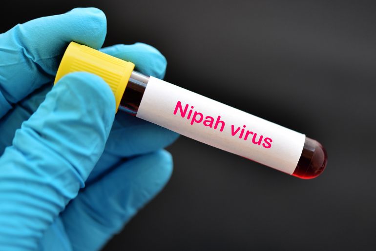 Nipah Virus 