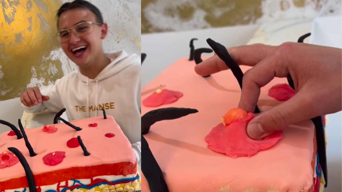 Acne-Themed Cake, Anyone? Dermatologist Spends Work Anniversary Popping Pimples On Cake