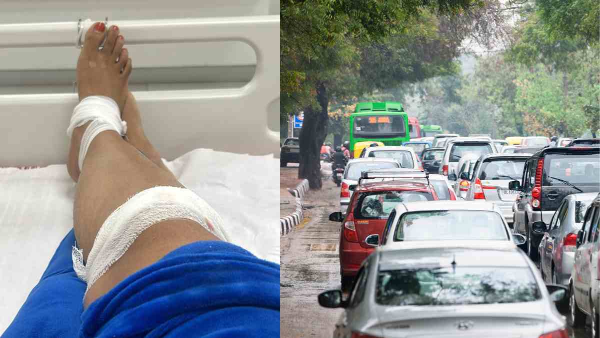 “Never Taking Rapido Again,” Bengaluru Woman Hospitalised After Rapido Rider Took Turn Without Indicator