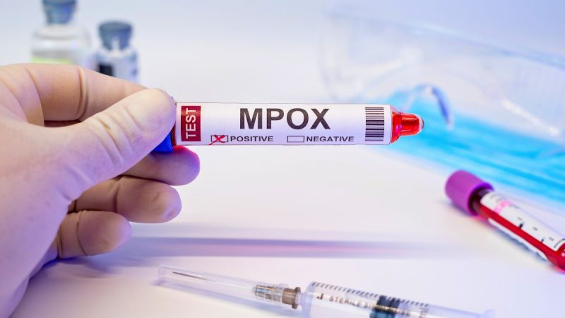 Mpox