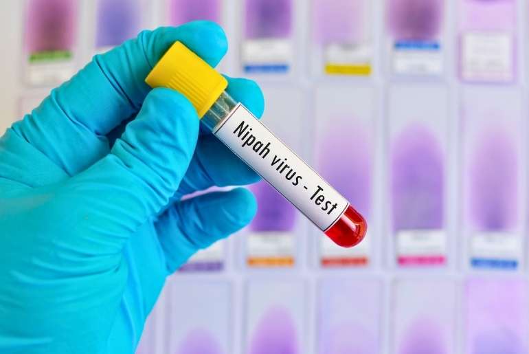 Nipah virus Kerala