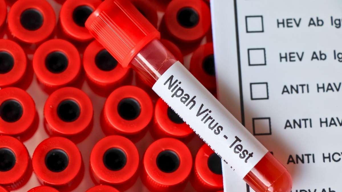 400+ People In Nipah Virus Contact List In Kerala; Causes, Symptoms & Precautions To Keep In Mind