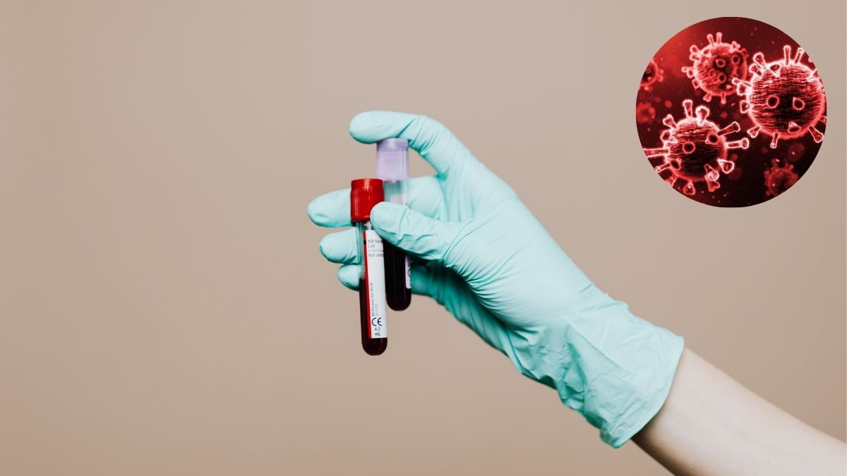 Second Nipah-Virus Related Death Reported In Kerala; Contact Tracing Underway