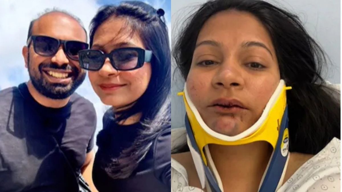 “Bleeding, Bruised And Broken Teeth”: Indian Couple Claims Brutal Assault By Chinese Hotel Manager In Switzerland