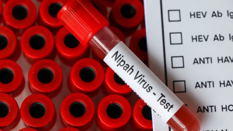 West Bengal Confirms 5 Nipah Virus Cases, 100 Quarantined; Check Symtoms, How To Protect Yourself