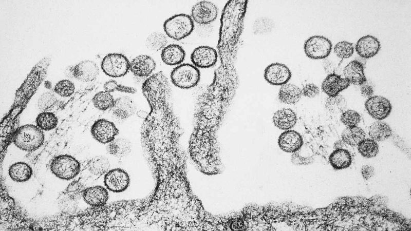 Can Hantavirus Remain Hidden In A Person’s Body For Years? New Study Raises Concerns