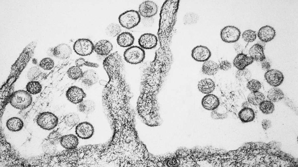 What Is Hantavirus? Why Are Cruise Travellers More Prone To Suffering From It?