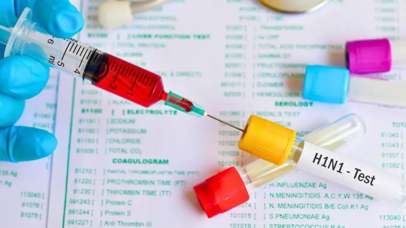 H1N1 Alert In Delhi As Cases Cross 1,700; Symptoms, Warning Signs & Precautions To Keep In Mind