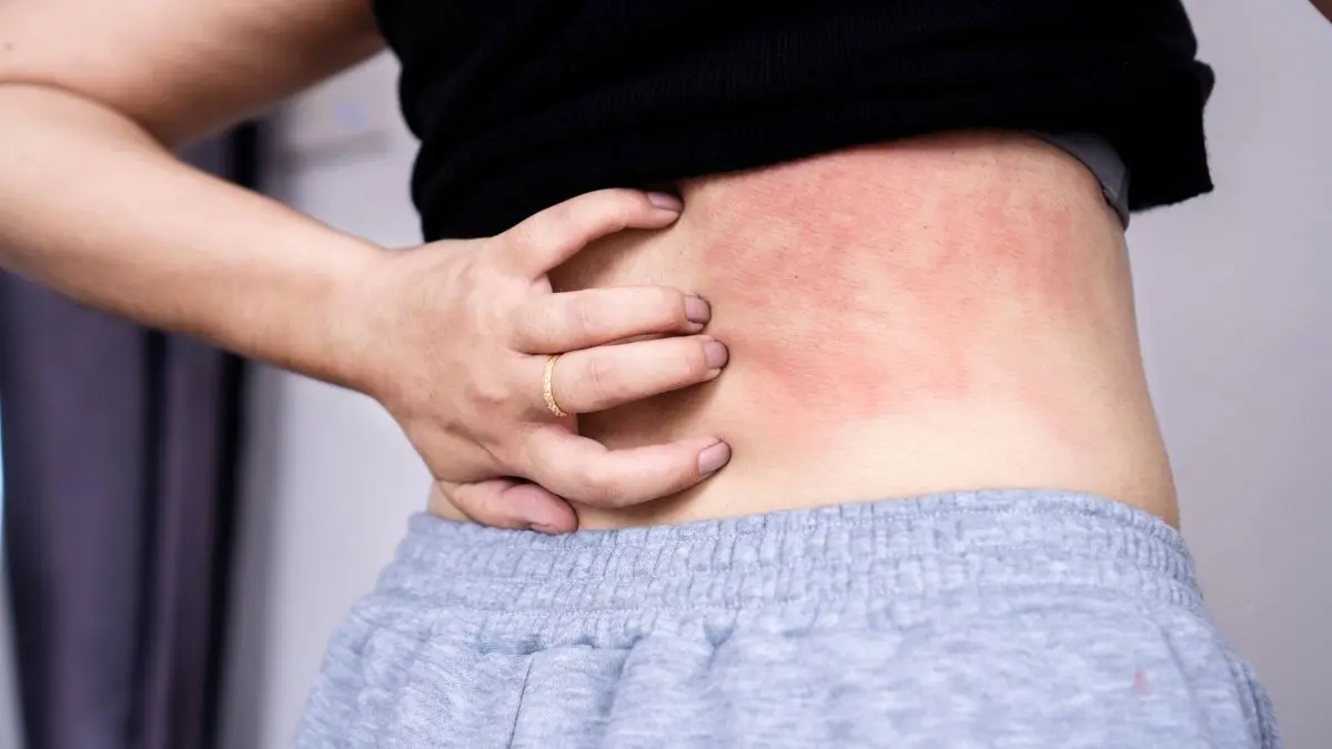 China’s Latest Wellness Trend Is Literally About Paying Someone ₹1,400 To Scratch You!